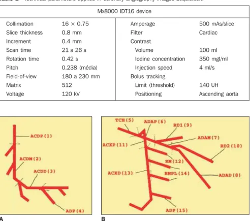 Figure 2. Coronary segments in compliance with the classification of the American Heart Association.