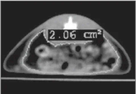 Figure 1. Measurement of the total area of abdomi- abdomi-nal fat tissue. CT of abdomiabdomi-nal section of rats in ventral decubitus for measurement of the total area of fat tissue.