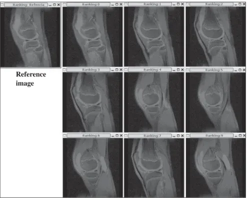 Figure 4. Curves regarding the execution of the first module utilized for images filtering.