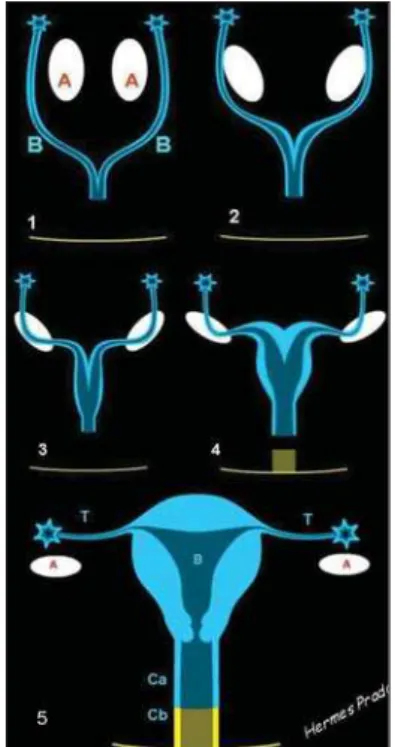 Figure 1. Scheme showing the embryological de- de-velopment and sequence (1 to 4) of Müllerian ducts fusion (B)