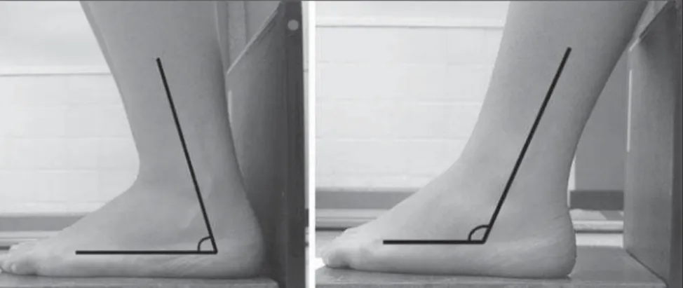 Figure 3. Positioning for x-ray imaging of the foot height. The result is shown on Figure 6.