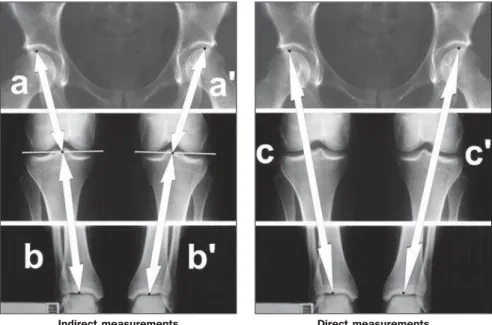 Figure 6. Sites of measurements for calculation of feet shortening.