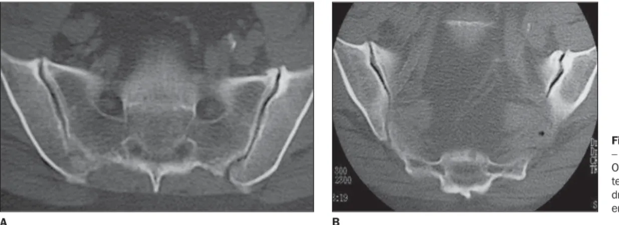 Figure 15. Tomographic cuts – axial and coronal planes.