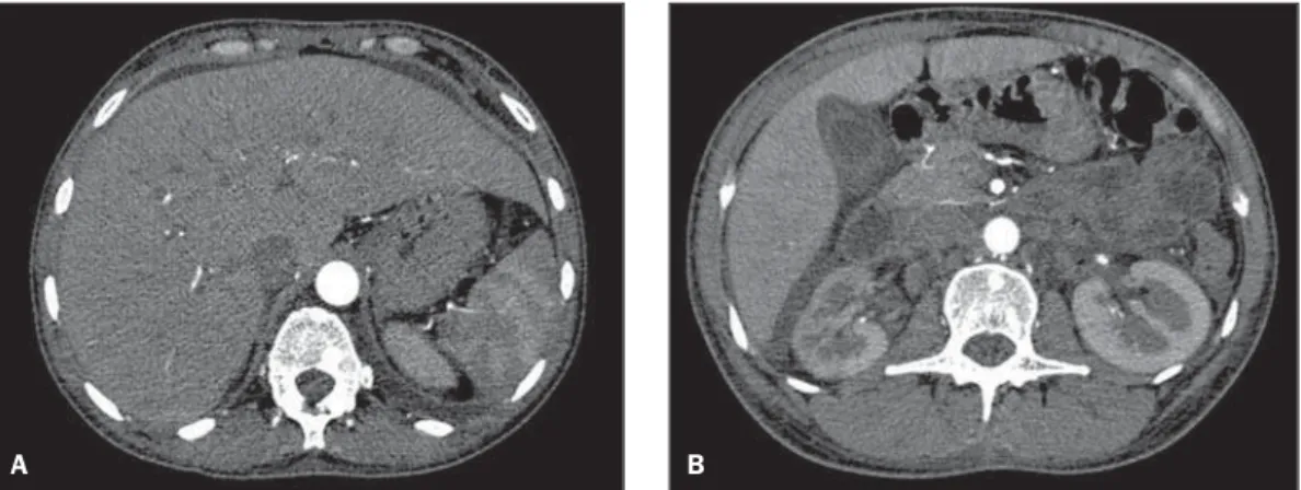Figure 3. Thoracic spine computed tomography: sagittal re- re-formatting (bone window).