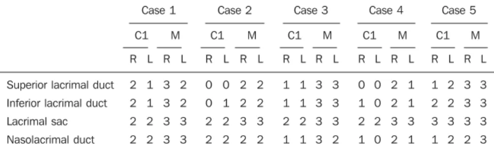 Table 1 Consensual scoring attributed by two observers to the identification of lacrimal pathways, ac- ac-cording to the coil utilized.