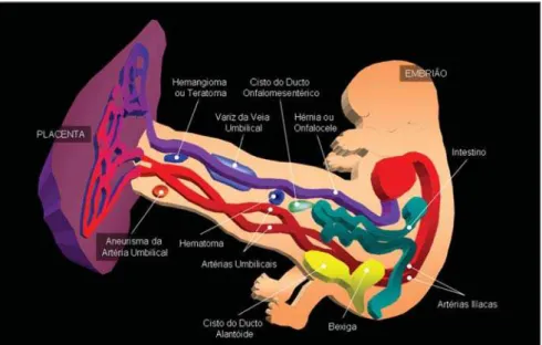 graphic studies whose sole finding had been the presence of umbilical cord cyst.