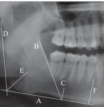 Figure 1. Morphometric mandibular indices based on related original articles (10–13) 