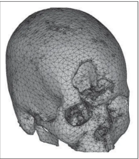 Figure 2. Visualization of 3D image, and coronal, sagittal and axial section planes after segmentation.