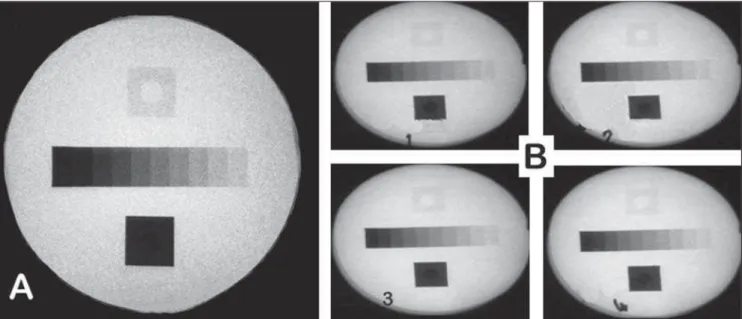 Figure 4. A: GS2 Leeds object (touched up frame). B: Images obtained in the pause function of videofluoroscopic studies resulting from filtration situations 1, 2, 3, and 4.