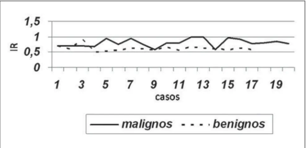 Figure 1. Distribution of resistance index values for benign and malignant nodules.