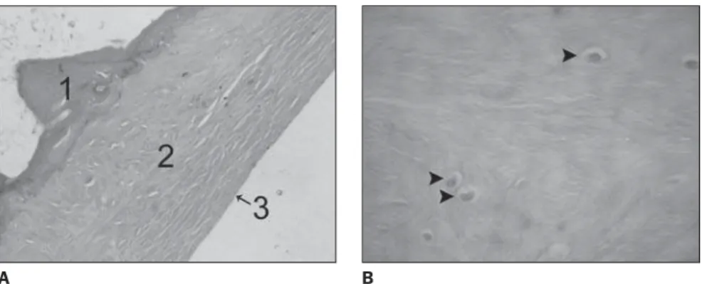 Figure 2. Radiographic aspect of the segments. Radiographic study of some peroneus longus tendon segments demonstrating the fibular ossicle in two specimens (26 and 28), absence of ossification in one (27), and a doubtful case (29).
