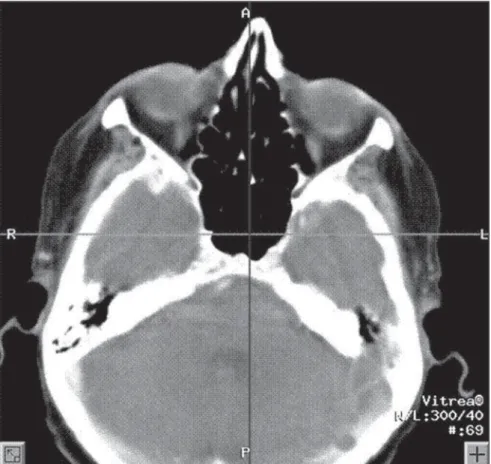 Figure 2. Utilization of computed tomography for human identification.