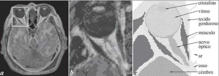 Figure 1. Axial section images. Head section (a), Gray-scale pixel matrix (b) and colorized tissues of the voxel-based model (c).