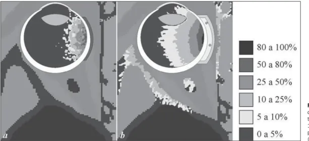 Figure 4. Percentual dose distribution in ocular  brachy-therapy.  Ruthenium/rhodium-106 plaque (a) and ROPES plaque with iodine-125 seeds (b).