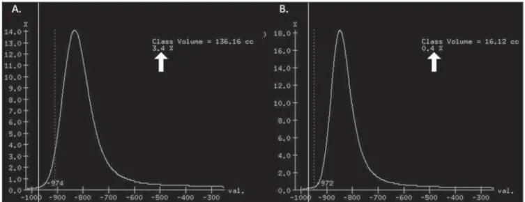Figure 1. A: Histogram of densities for the calculation of pulmonary emphysema with CT in a non-smoking young patient, utilizing a dose of 120 kV and 10 mAs