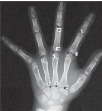 Figure 1. Distribution of images from the data bank in accordance with the mean value found on clinical reports.