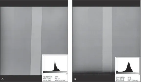 Figure 2. Comparison between images from the CR imaging  sys-tem for 117 kVp and 4 mAs  ex-posure factors from the Siemens equipment (high frequency) (A) and from the Emic equipment (12