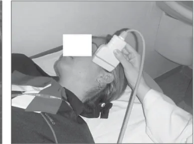 Figure 4. US transducer positioning for the study of TMJ articular disc.