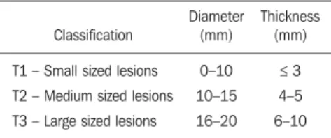 Table 1 Uveal melanoma staging (2) .