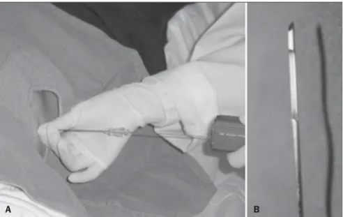 Figure 4. A: Cutting needle (tru-cut) biopsy coupled with automatic spring-activated triggering system.