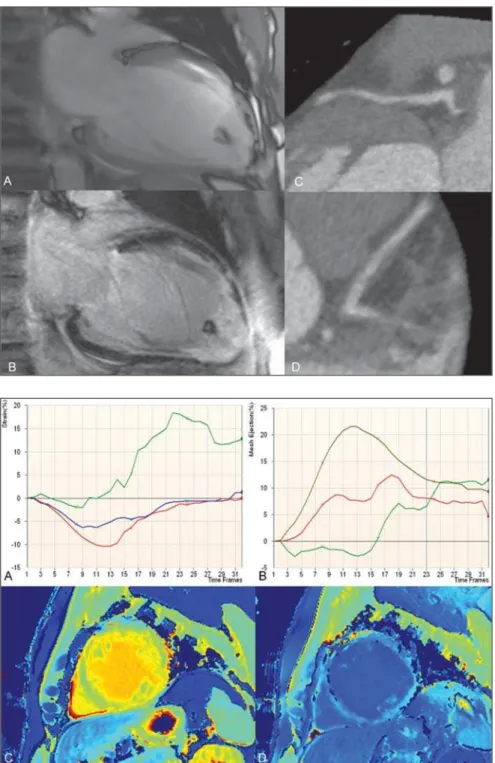 Figure 1. ECG-gated CMR (A,B) and CTA (C,D).