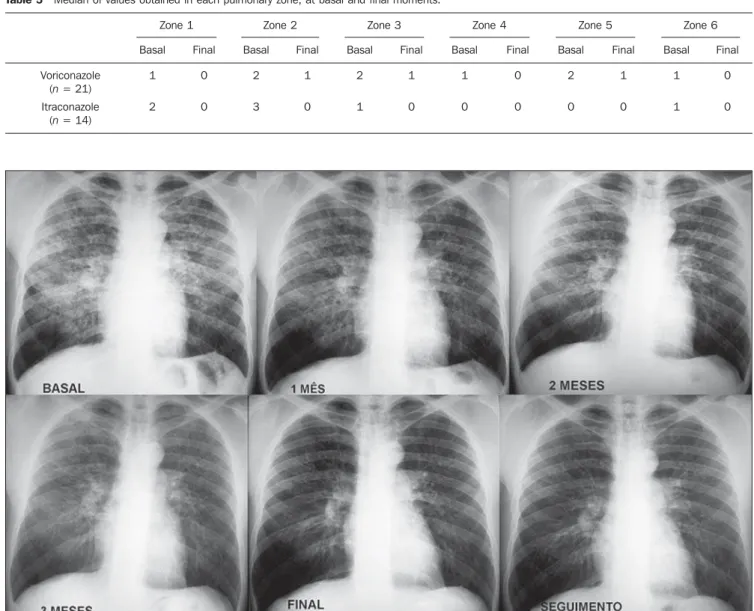 Figure 6. Continuous and gradual improvement of pulmonary radiographic changes in a patient treated with voriconazole.