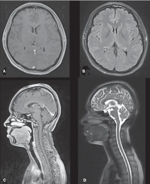 Figure 4. Head and neck regions. Gadolinium-enhanced T1-weighted 3D gradient-echo fat-suppressed axial (A) and sagittal (C)