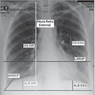 Figure 1. Measurements evaluated at radiography.