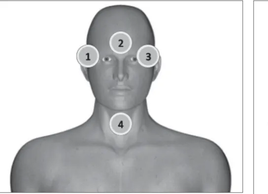 Figure 1. Positioning of dosimeters on the patient.