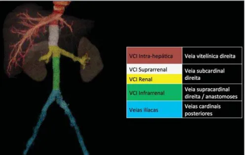 Figure 1. Three-dimensional reconstruction with volume rendering. The anatomic segments of the IVC are separately colored, with highlighted embryonic origins.