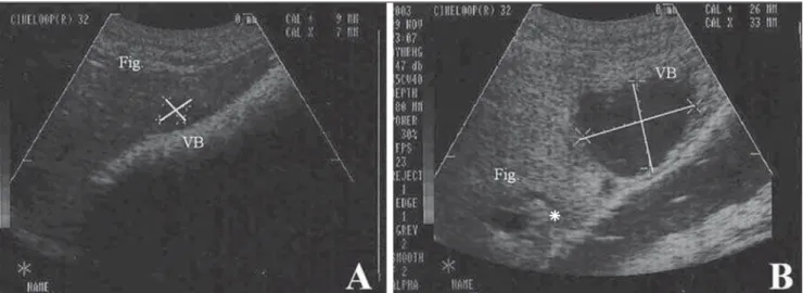 Figure 2. Sonographic images showing the gallbladder (lines) of a pig experimentally submitted to surgical biliary obstruction