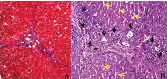 Figure 4. Photomicrography of left lateral hepatic lobe specimen from a pig experimentally  submit-ted to biliary obstruction