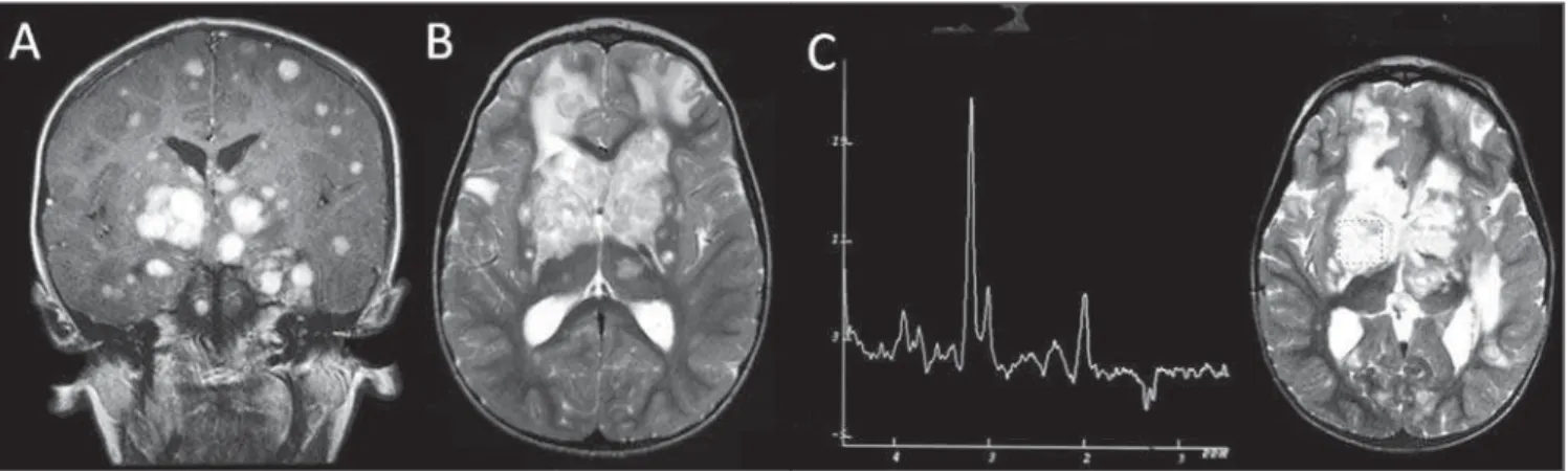 Figure 1. Female, 53-year-old patient.