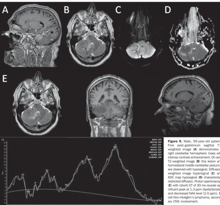 Figure 9. Male, 59-year-old patient.