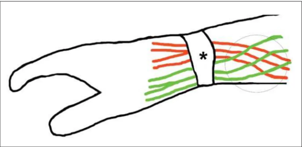 Figure 5. Intersection syndrome of the forearm.
