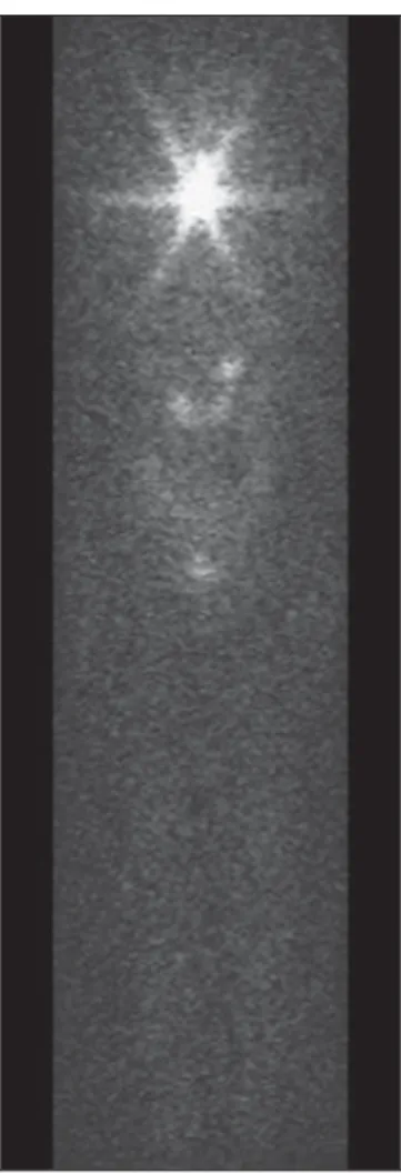 Figure 2. Nuclear medicine image obtained from a catalogue (9) .