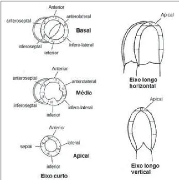 Figure 2. Image of left ventricle with recommended terminology of the 17 seg- seg-ments for tomographic images of the heart.