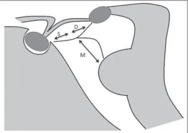 Figure 1. Schematic illustration of the LM anatomy, demonstrating the three segments of the Liliequist membrane in the sagittal plane