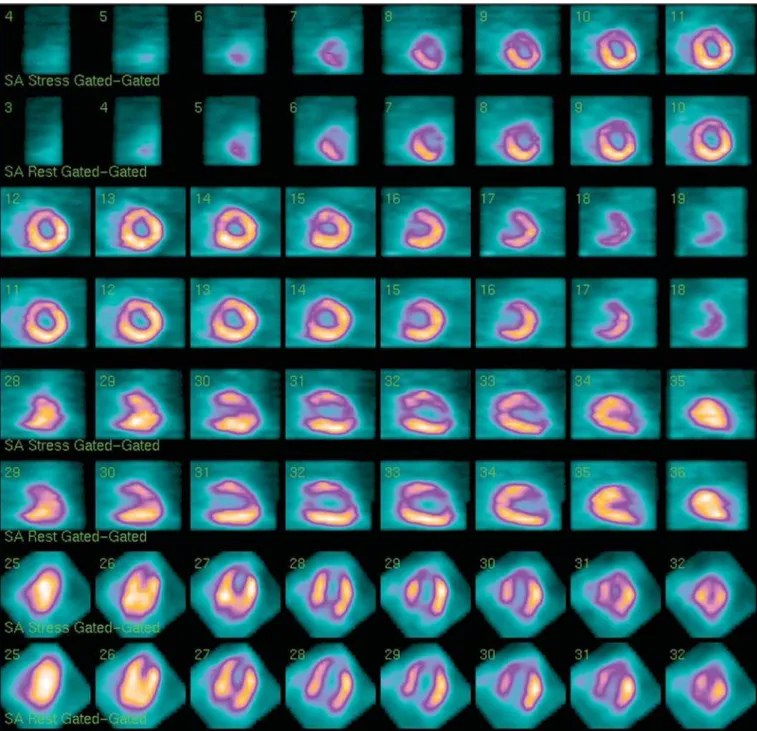 Figure 5. Resulting images from processing using four iterations and four subsets.