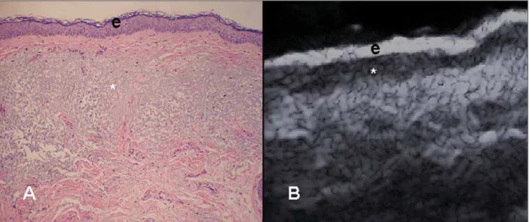 Figure 4. Glabrous skin. A: Histology. Thicker corneous layer and presence of stratum lucidum (asterisk)