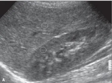Figure 1. Sonographic images demonstrating the regions of interest. A: Liver US of an eutrophic adolescent