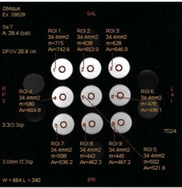 Figure 4. Image of the test object analyzed with a ROI with 6 mm in diameter.