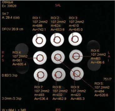 Figure 6. Image of the test object analyzed with a ROI with 12 mm in diameter.