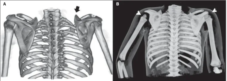 Figure 6. Examples of three-dimensional volume rendering of computed tomography images acquired from two different patients