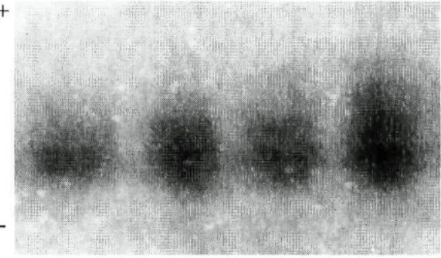 Figura 3.1.5: Padrão de PGD observado por electroforese convencional  em gel de amido