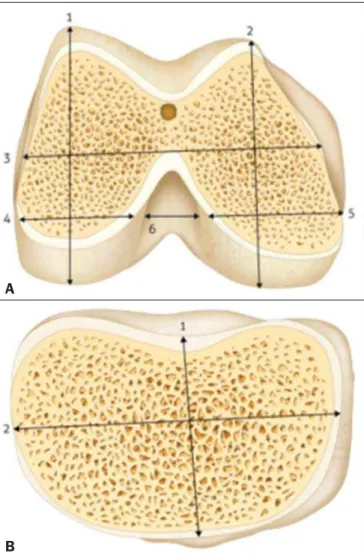 Figure 1. Schematic of the measurements. A: Distal right femur: 1, lateral condyle height; 2, medial condyle height; 3, total femur width; 4, lateral condyle width, 5, medial condyle width; 6, intercondylar width