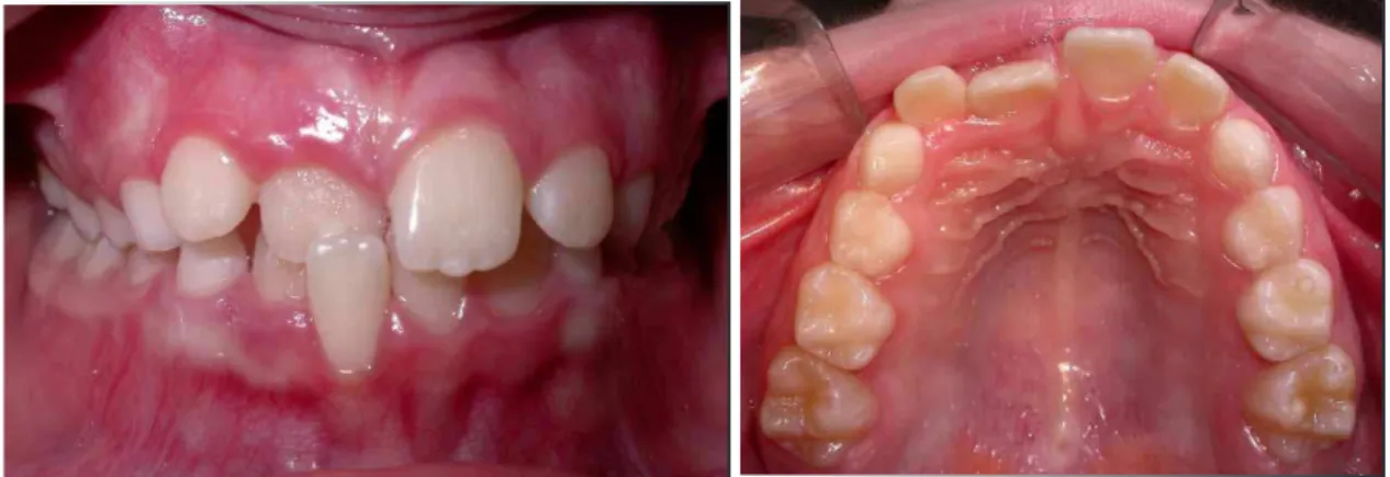 Figure 1.  Initial intraoral views.
