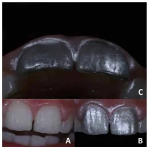Figure 6.  Final images, after 1 week, of the restorative treatment performed: 