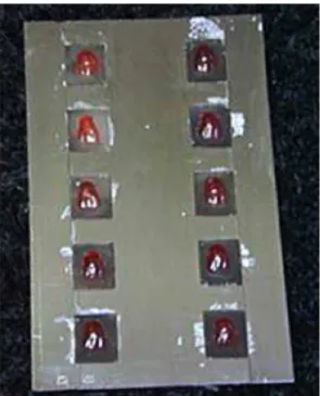 Figure 1.  Metal matrix with acrylic resin and teeth in position.