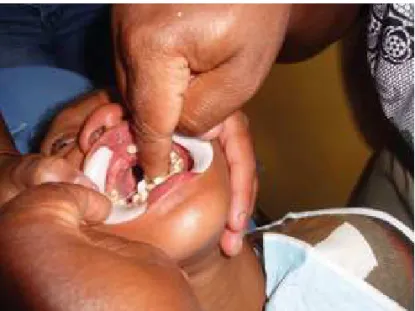 Figure 6. oral hygiene practice carried out by the mother. Nova Friburgo, RJ,  Brazil, 2014.